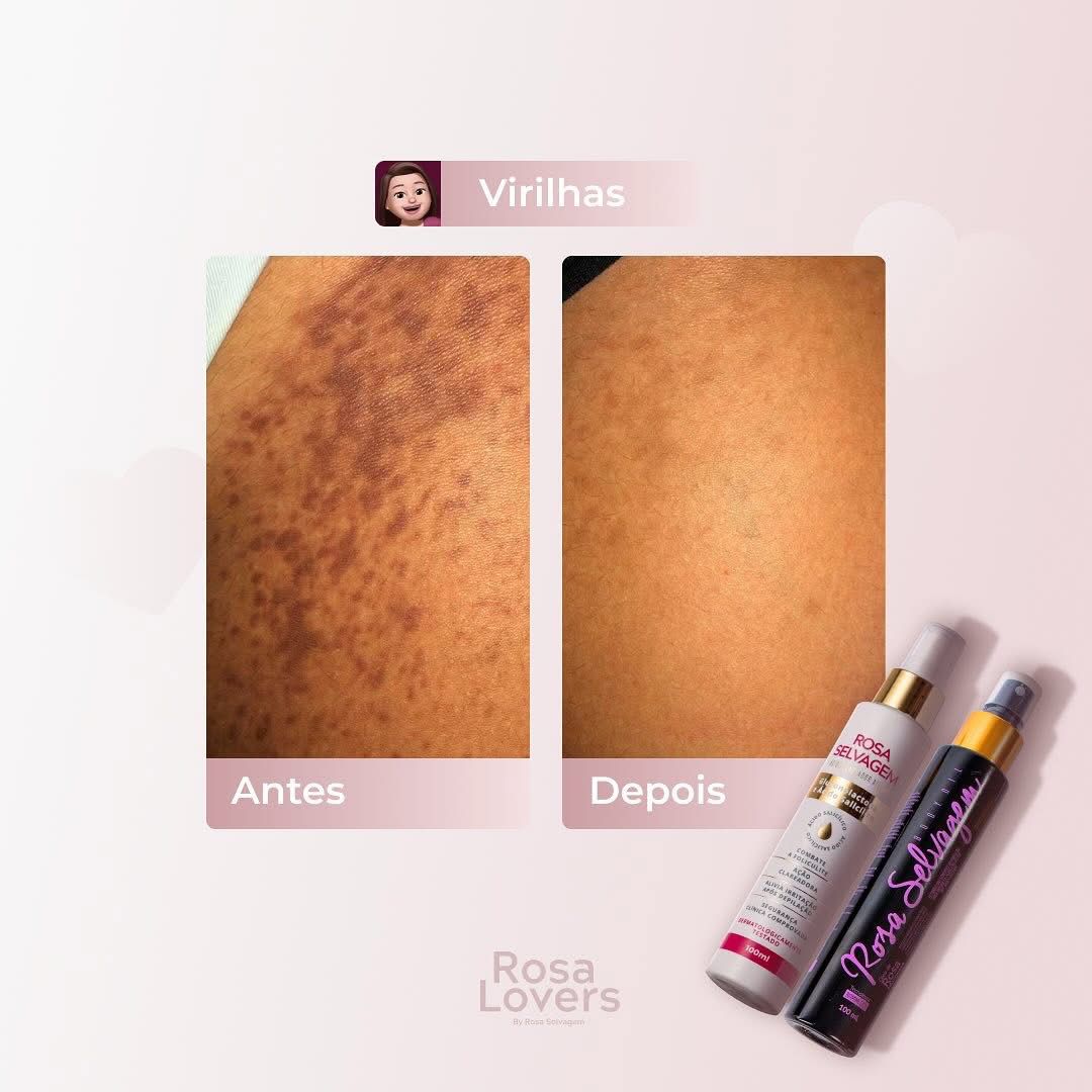 Antes e depois Rosa Selvagem nas axilas