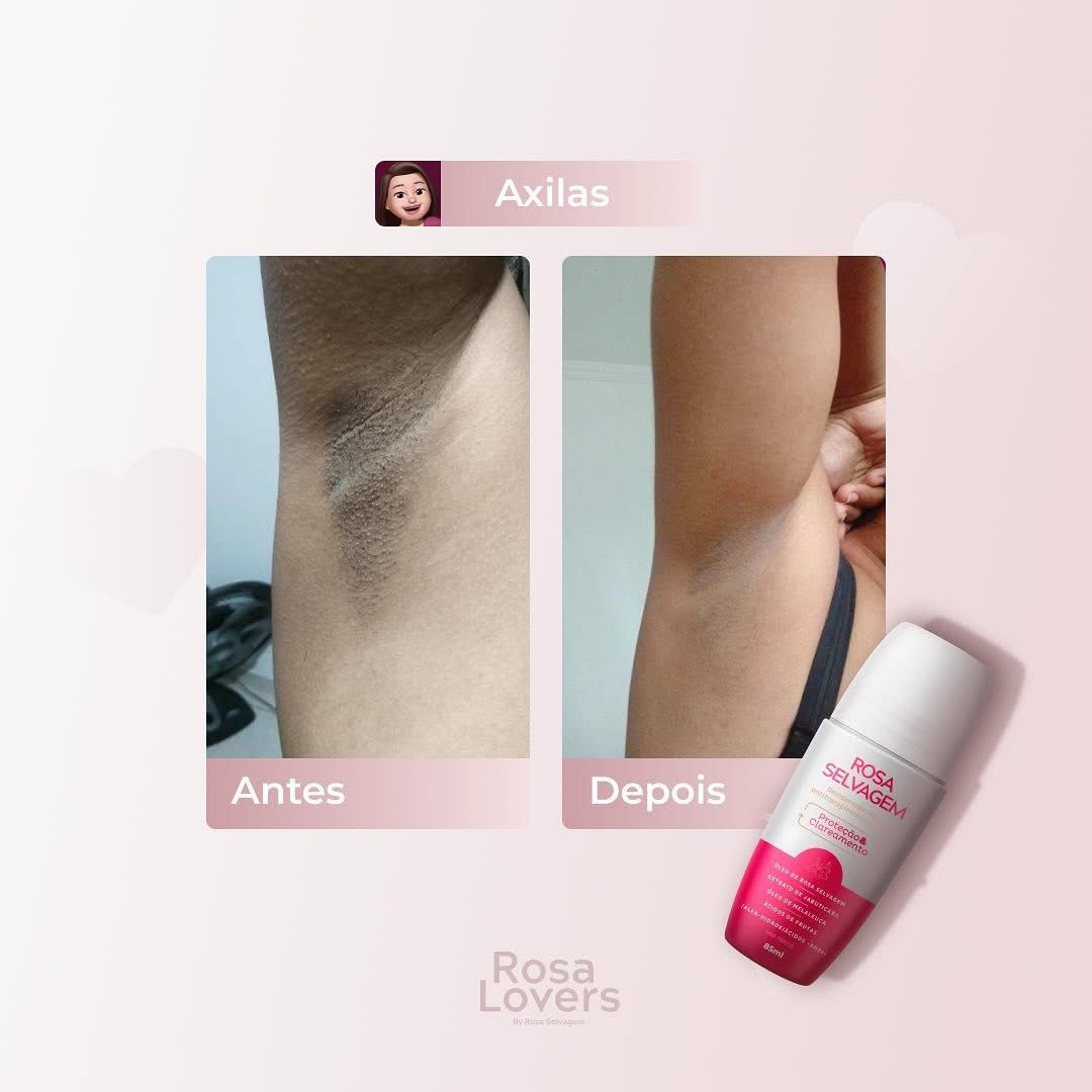 Evolução Rosa Selvagem