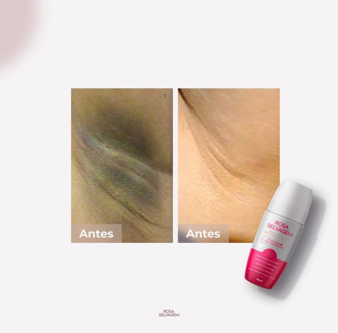 Antes e depois Rosa Selvagem no rosto